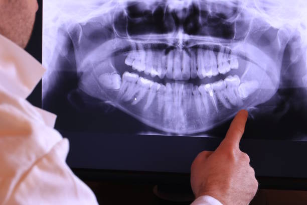 Best Broken or Chipped Tooth Repair in Steger, IL